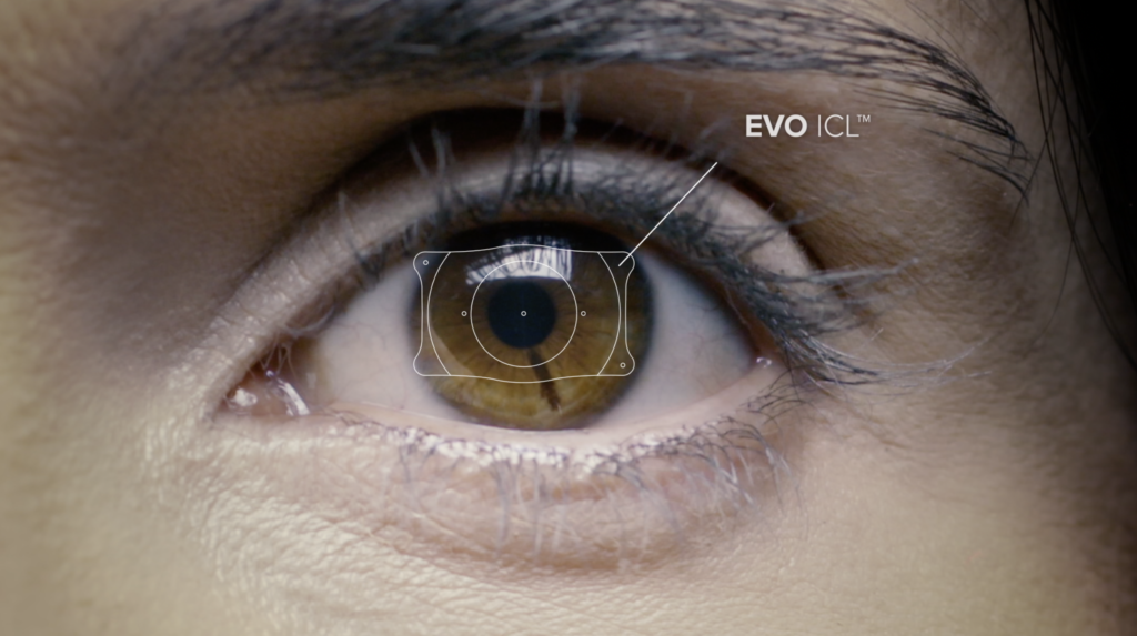 Launching a New EVOlution in Vision Correction